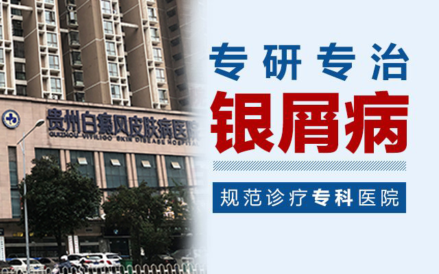 贵州银屑病专研专治